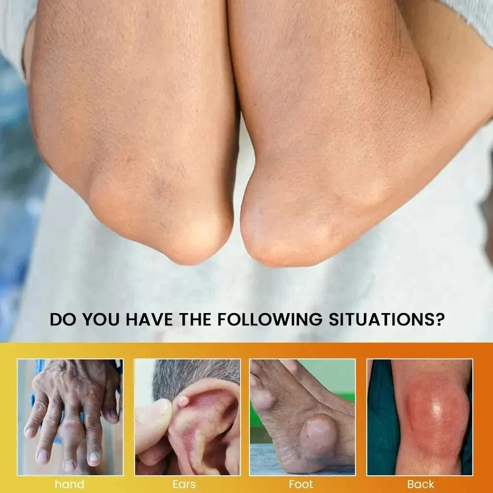 Sumifun - Gout Relief Cream